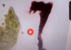 Woman Coughing And Throwing Up Synthetic Biological Creatures, She Feels Them Under Her Skin And In Her Brain, And She Sees Them In Her Stool Too!! Watch One Creature Wiggle In Astounding Footage!!